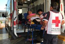 Fractura